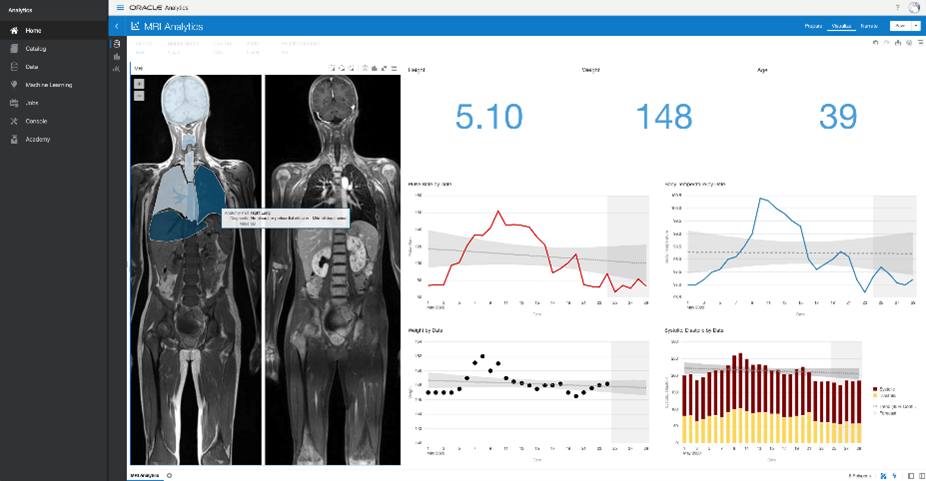 Información en Oracle Analytics Cloud